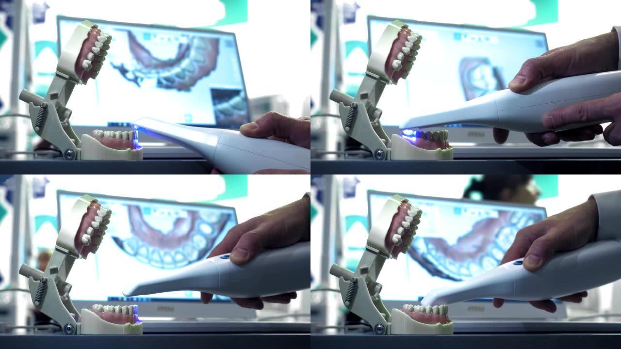 手动3D牙齿扫描仪。医生扫描下巴上的一颗牙齿。牙医扫描牙齿。牙科新技术。