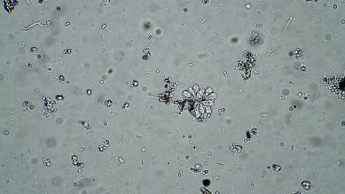 细菌在水中的Synura heterokont藻类