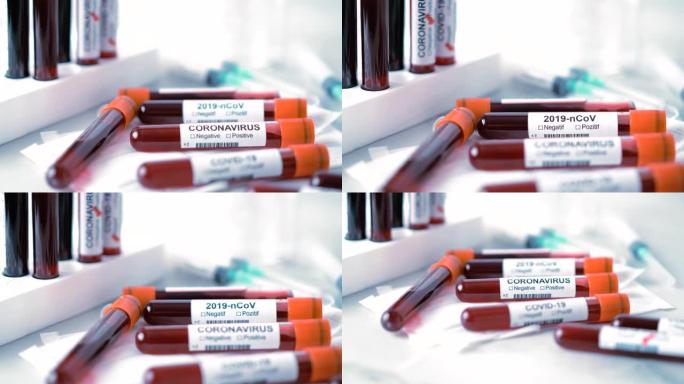 冠状病毒、Covid-19和2019新型冠状病毒几种血液试管
