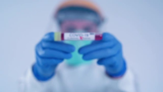 医疗实验室工作人员戴着蓝色手术手套，手持阳性血液样本管测试冠状病毒新型冠状病毒肺炎 (2019 nc