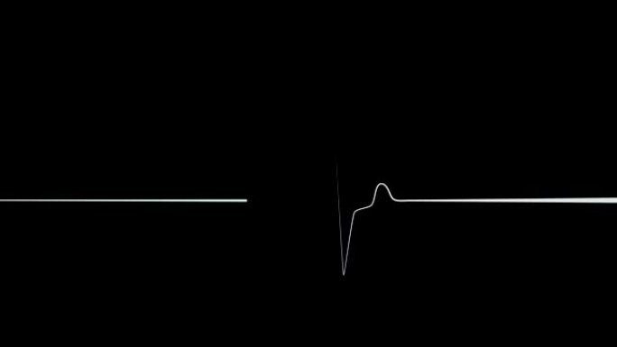黑色背景上的心脏冲动序列