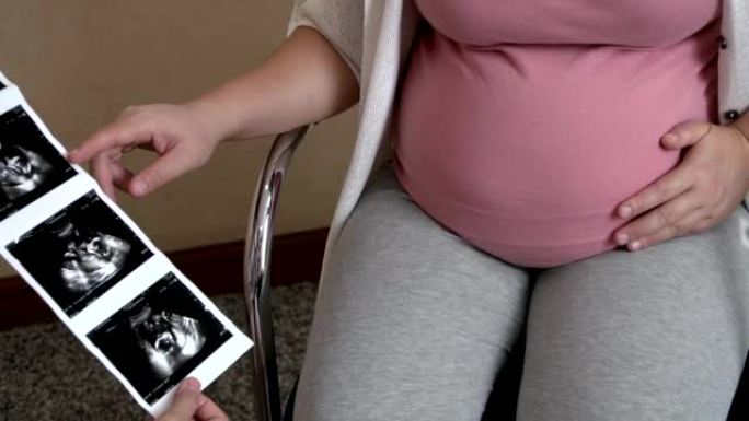 孕妇和妇科医生在医院