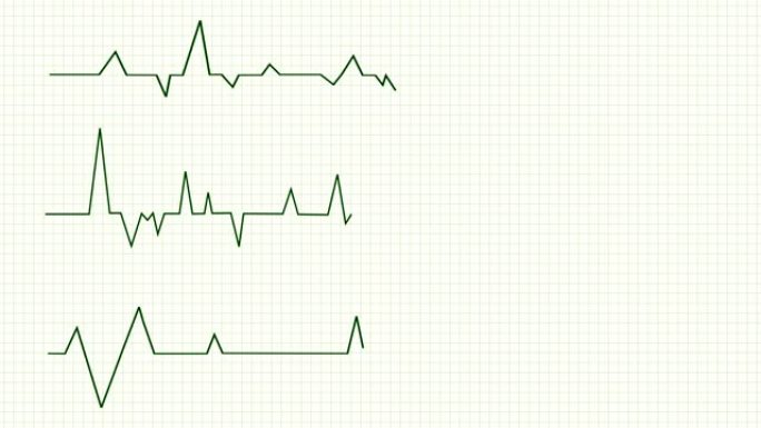 心跳动画。心电图模板。4 k的视频