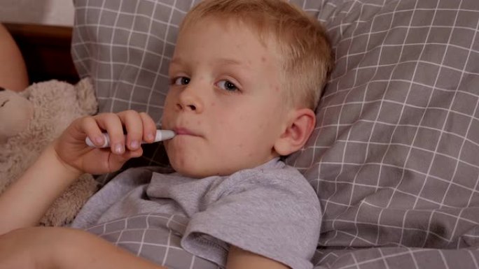患有水痘的小男孩躺在床上，嘴里叼着温度计。