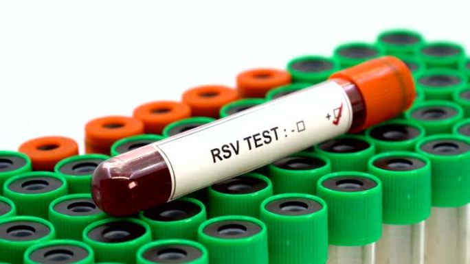 合胞体病毒 (RSV) 检测