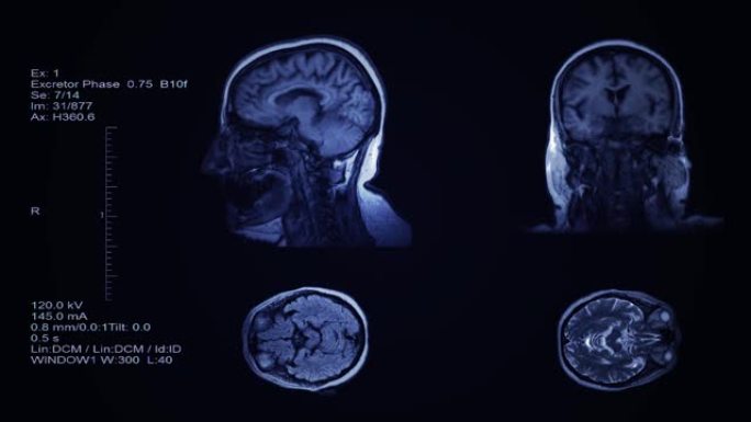 头部和大脑计算机断层扫描结果可视化。人头筛查的四个分区幻灯片。三维医学放射学检查