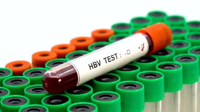 Hbv病毒检测检测