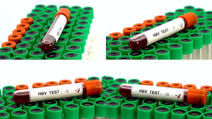Hbv病毒检测检测