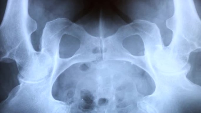 研究骨盆骨x射线的医生，4K