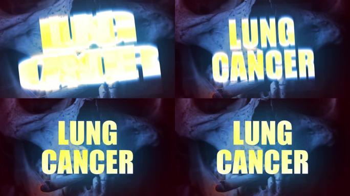 肺癌与香烟和头骨肺癌与香烟和头骨