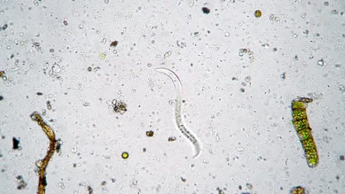 长蠕虫是一种被许多细菌包围的线虫