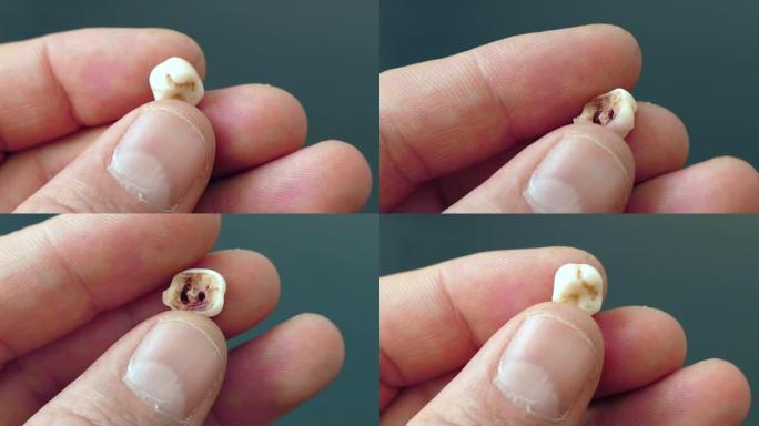 人牙，特写，婴儿的临时乳牙，
