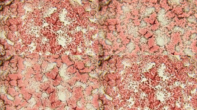 血细胞通道100x (HD 60p)。在卤素细菌学显微镜的帮助下，血小板以100倍的放大倍数形成一条