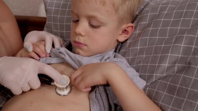 医生用听诊器检查一个患有水痘的小孩。