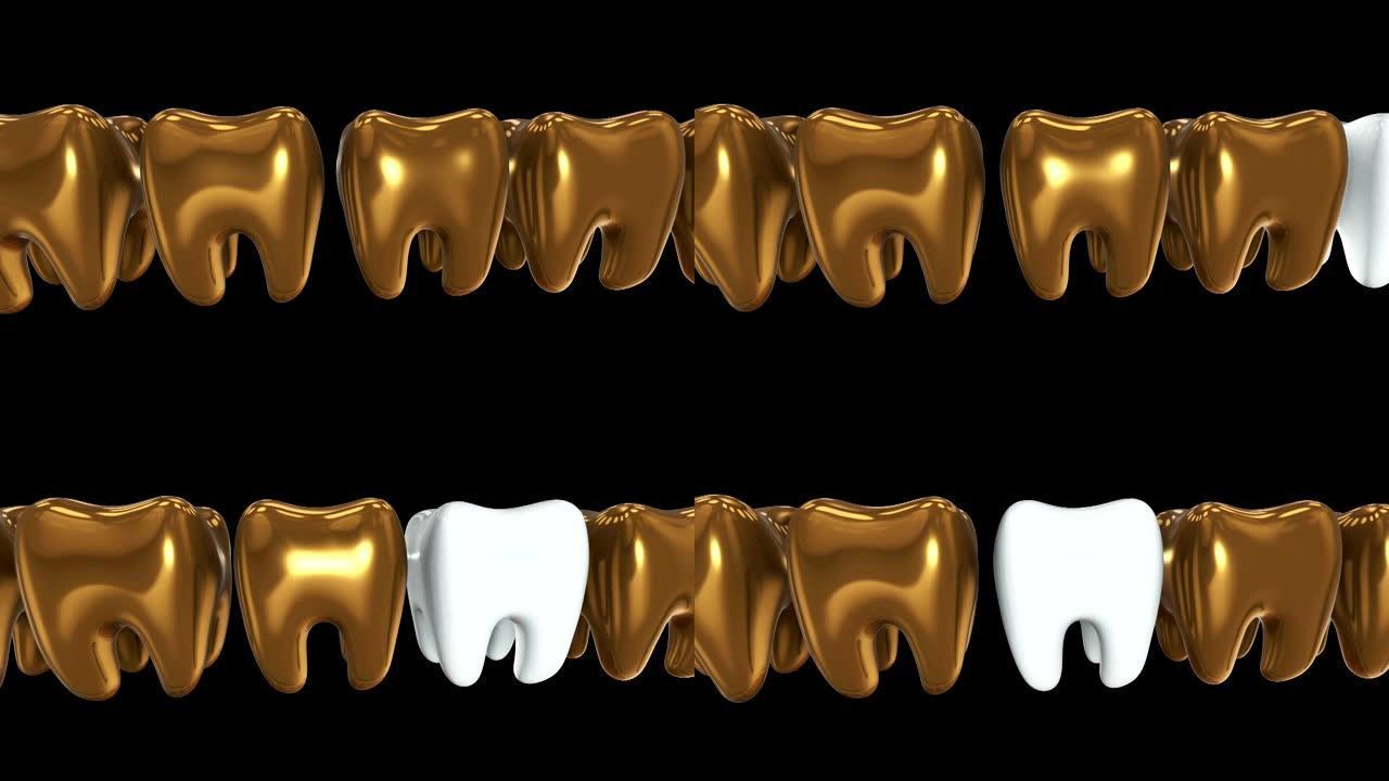 一排金牙中的白牙。3D渲染。牙科，出众，经营理念。
