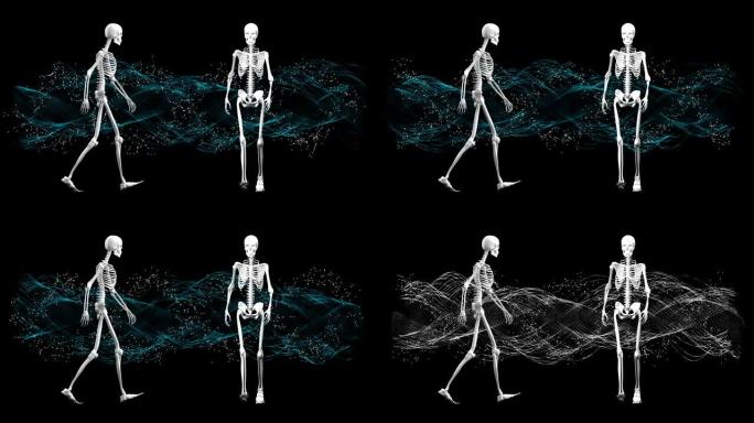 骷髅在现场行走骨头白骨科技