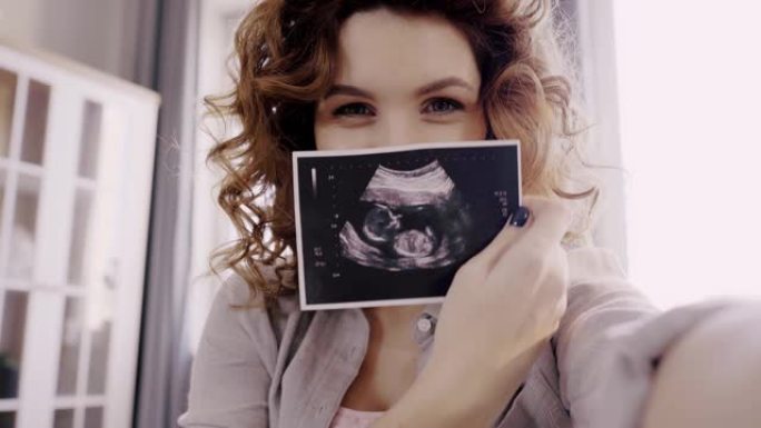 孕妇在相机上显示胎儿超声图像