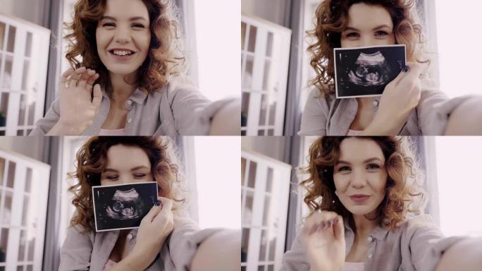 孕妇在相机上显示胎儿超声图像