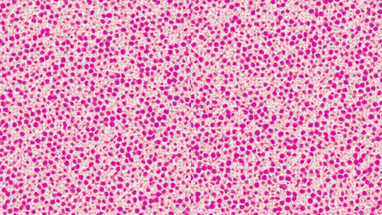 组织细胞模拟粉色光斑