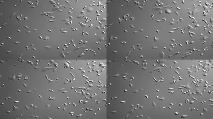人类癌细胞细胞细胞素材显微镜