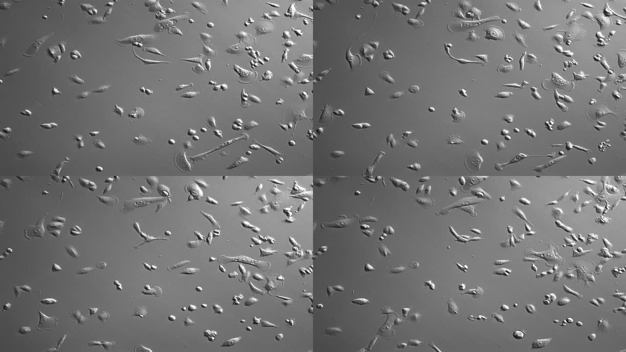 人类癌细胞细胞细胞素材显微镜
