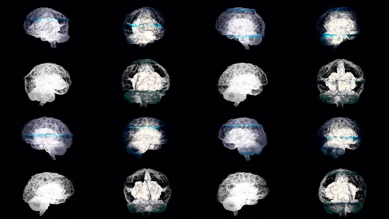 四个大脑在黑色背景上进行mri扫描，健康概念。动画。在医疗过程中，人脑，左右半球，无缝循环