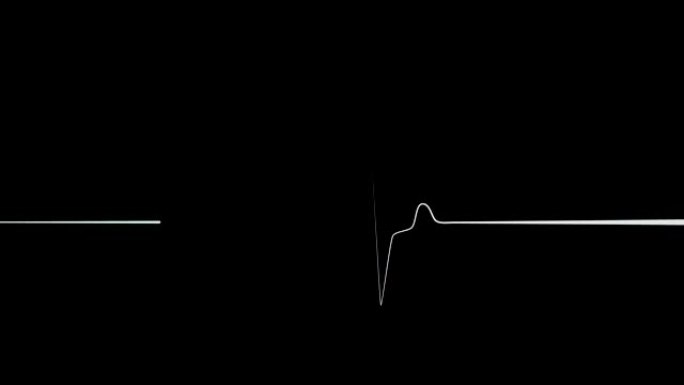 黑色背景上的心脏心电图