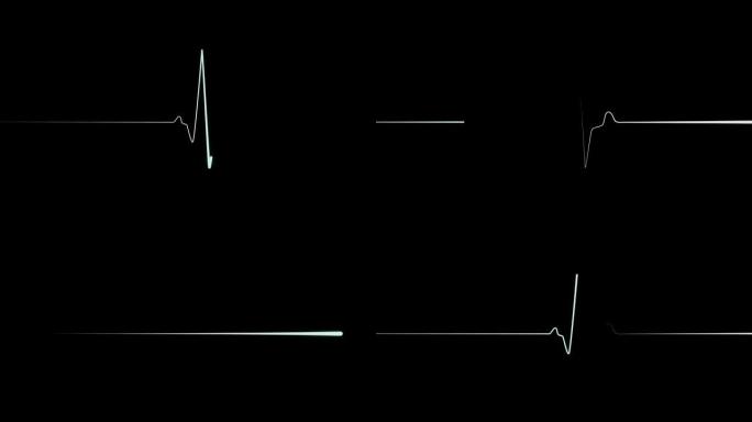 黑色背景上的心脏心电图