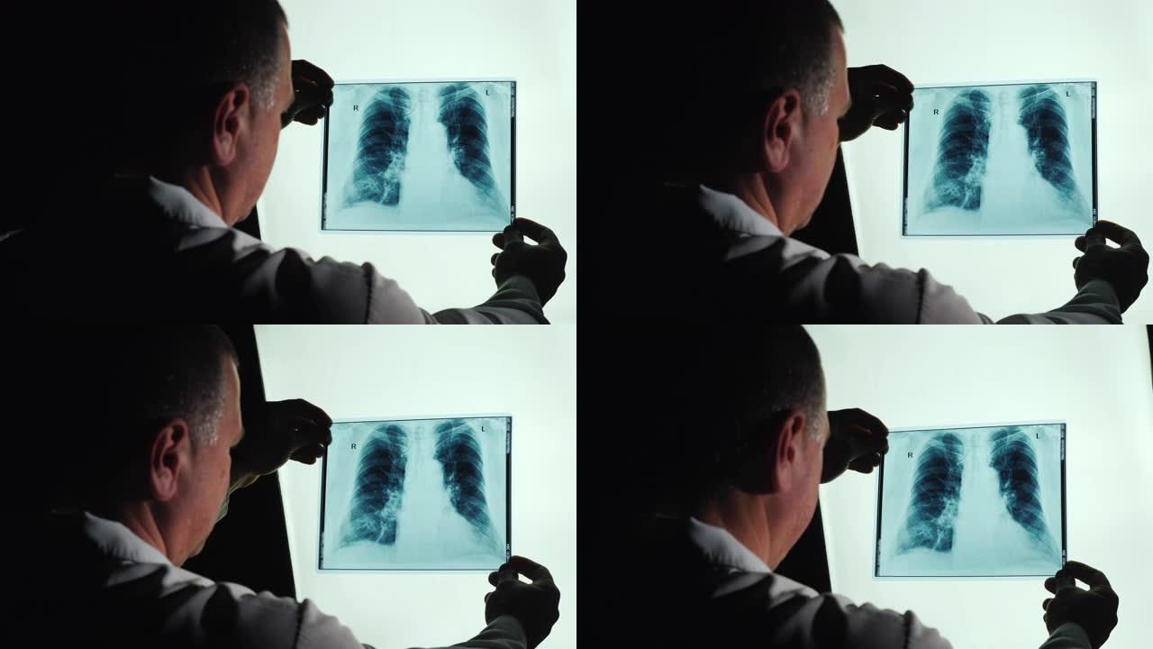 医生检查肺部x射线