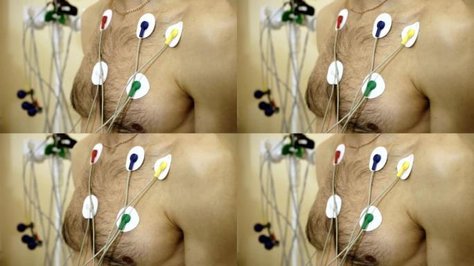 患者胸部动态心电图监测装置。