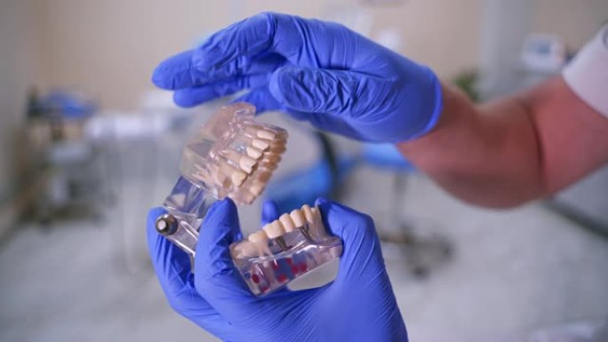 医生在塑料颚样本或模型上展示假植入物。