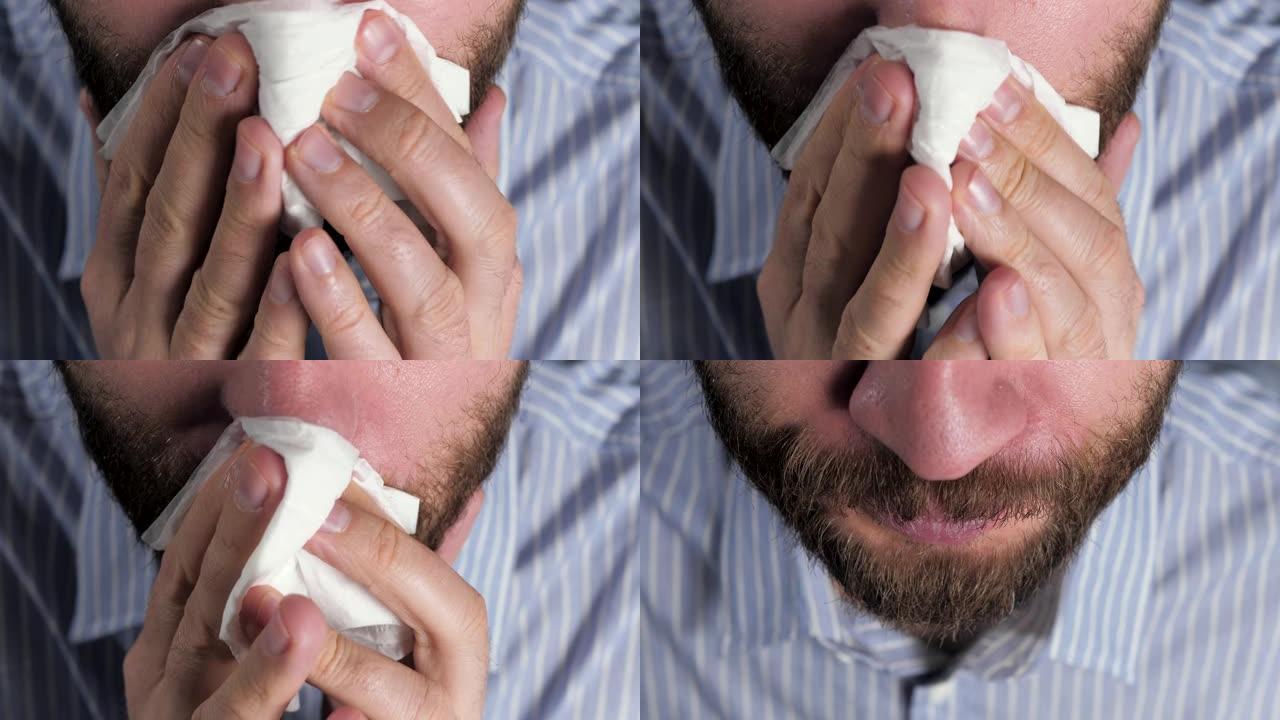 男人用纸巾擦鼻子。流鼻涕，感冒，流感，过敏，灰尘，猫毛，鼻炎，体温过低，空气干燥的概念。顶视图。特写