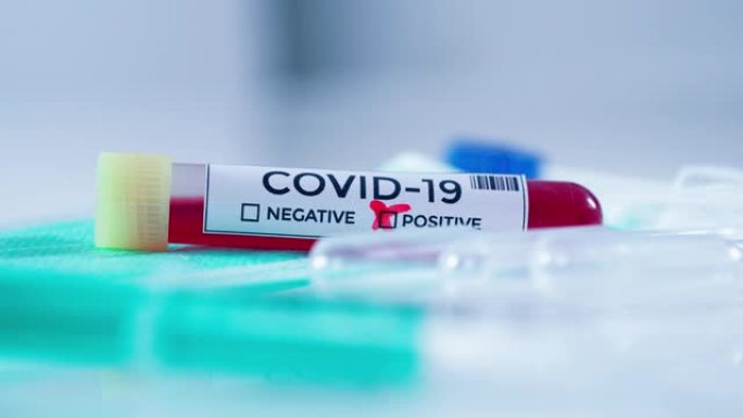 实验室新型冠状病毒肺炎医疗台上的近距离阳性血液样本管冠状病毒 (2019 ncov)