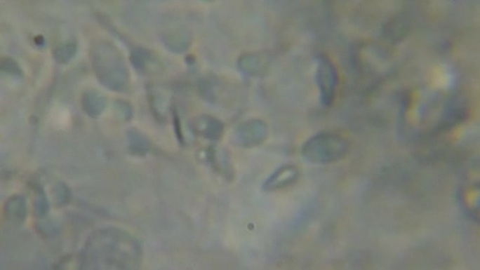 在相衬显微镜下移动的人类精子。显微镜下观察的精子。特写显示精子。人类精液的视频。宏观的特写镜头。医学