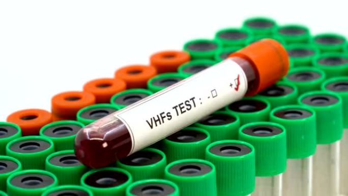 病毒性出血热 (VHFs) 诊断试验