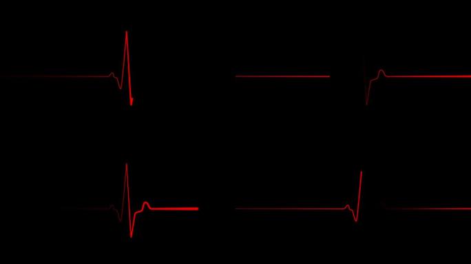 心跳平坦线，屏幕上的心脏冲动序列