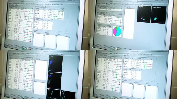 分析血液。监视器的特写镜头，上面有血液检测结果。高清