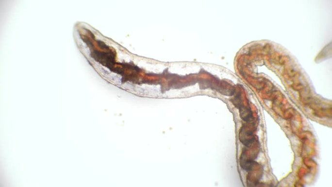 显微镜下的血虫 (甘油，线虫)