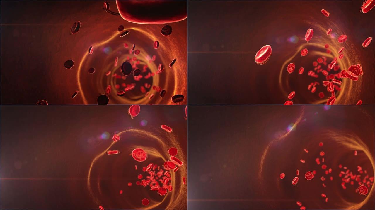 红细胞上的病毒红细胞上的病毒细菌
