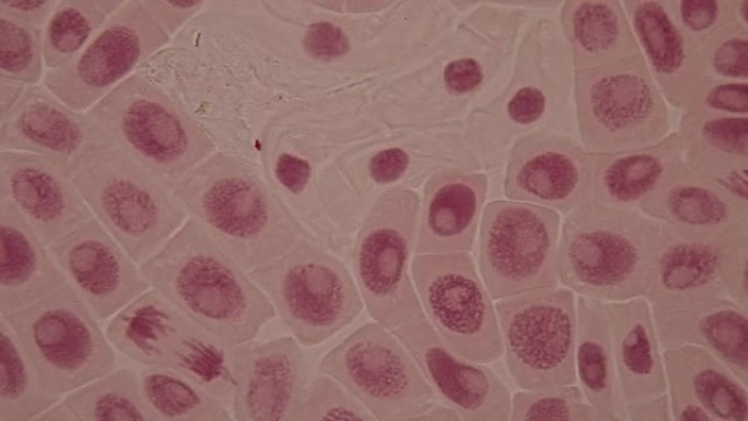 显微镜下洋葱根尖和有丝分裂细胞。