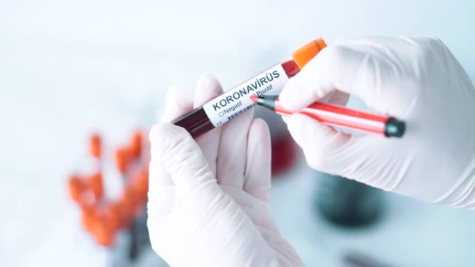 冠状病毒血液试管标记阳性-土耳其语Koronavirüs