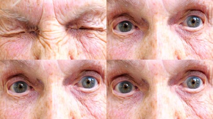 老年妇女看着镜头，强烈地拧起眼睛。特写皱纹的女性脸，睁大眼睛，露出惊讶的情绪。面部表情惊讶的奶奶。慢