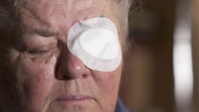 白内障手术后有保护性眼罩的老妇人。