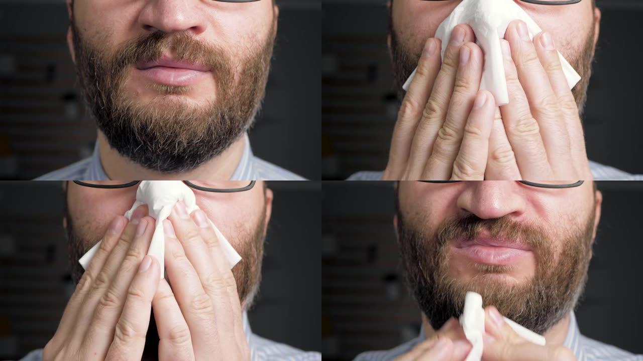 男人用纸巾擦鼻子。流鼻涕，感冒，流感，过敏，灰尘，猫毛，鼻炎，体温过低，空气干燥的概念。前视图。特写
