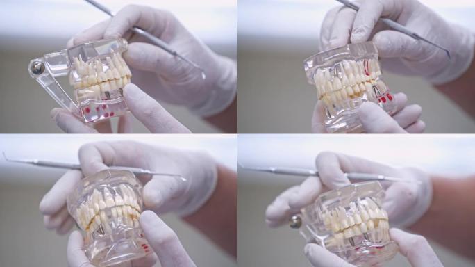 牙医手中的现代下巴模型。