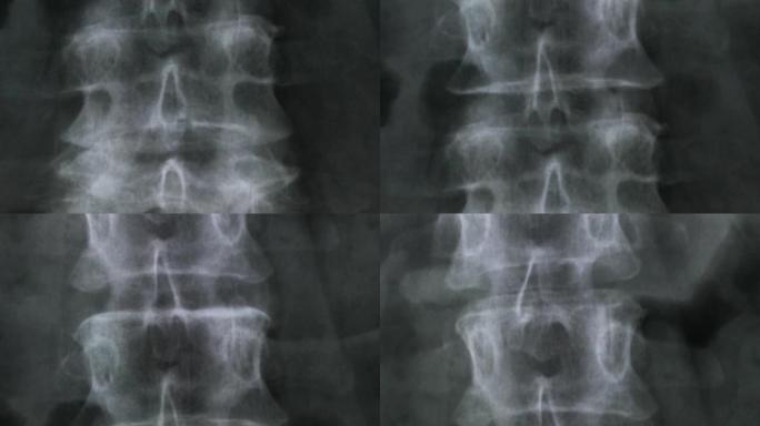 人体脊柱和骨盆骨骼的x射线，4K