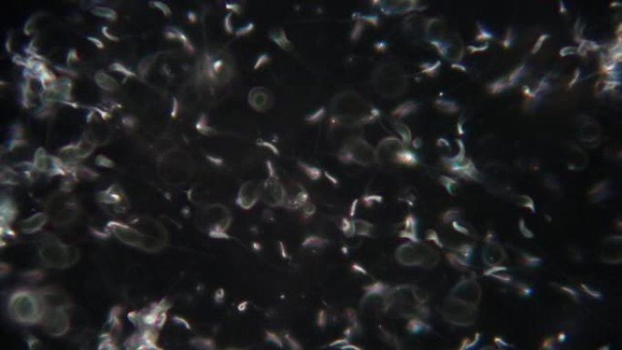 实验室显微镜下鸡精子的研究。
