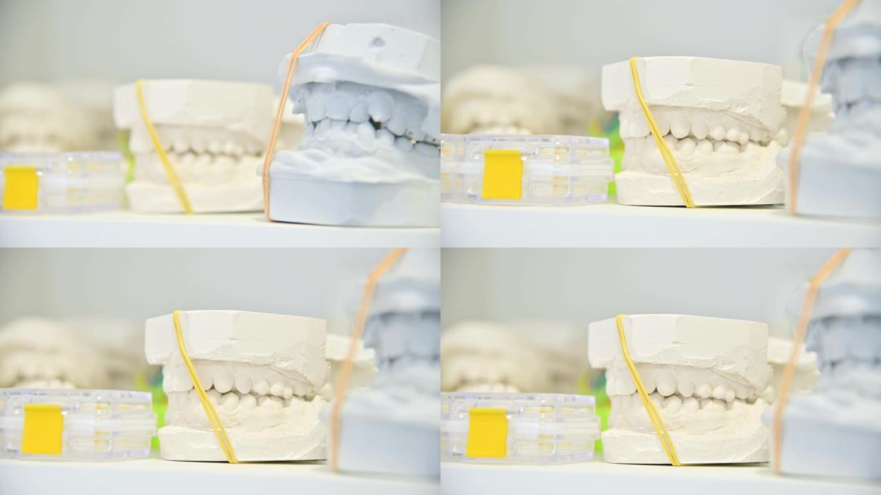 人类牙颌石膏模型铸造。实验室假肢。特写