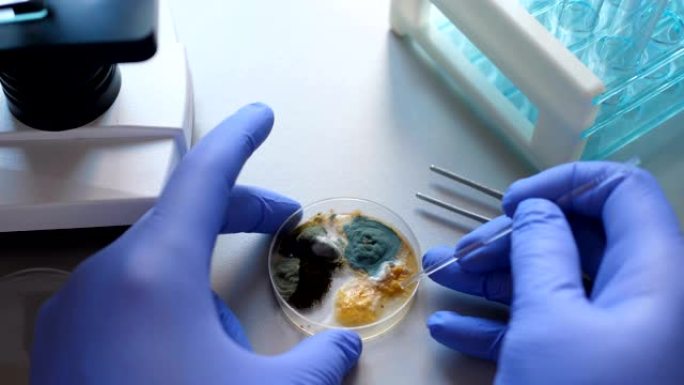 科学家在细菌培养中进行分析。特写镜头。化学实验室细菌培养皿。手拿蓝色手套的培养皿与霉菌和细菌菌落。科