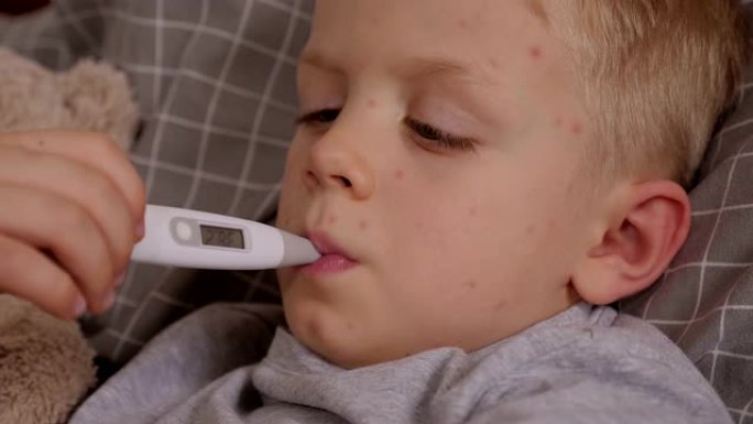 患有水痘的小男孩躺在床上，嘴里叼着温度计。